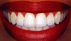 Coffee Whitener