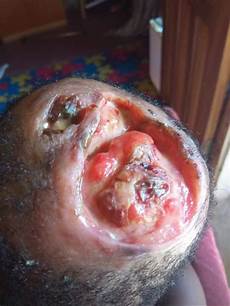 Dishes Head